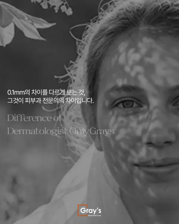 부산피코토닝 색소치료 레이저토닝만 진행해서는 소용없습니다 — 이미지 2